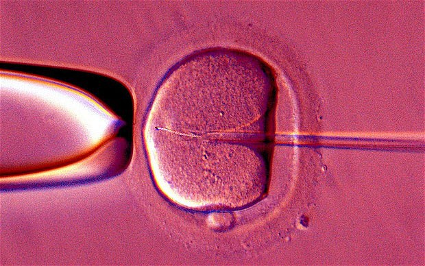 IVF 2355941b