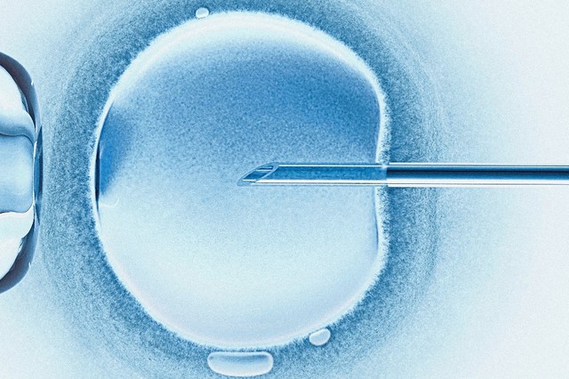cover procreation assistee